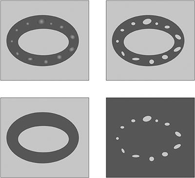 Automation of Bone Tissue Histology